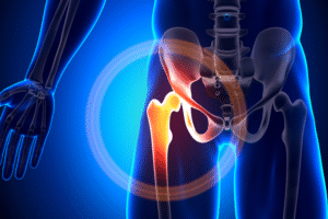 tight hip flexor image
