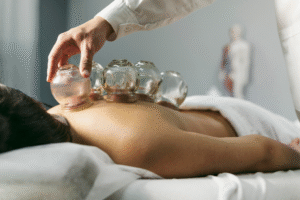 dry cupping procedure