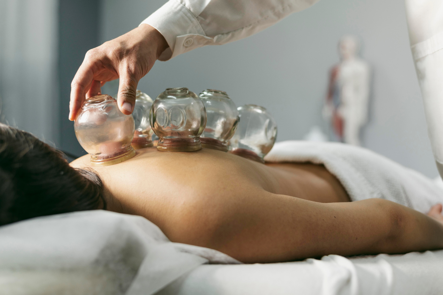 dry cupping procedure