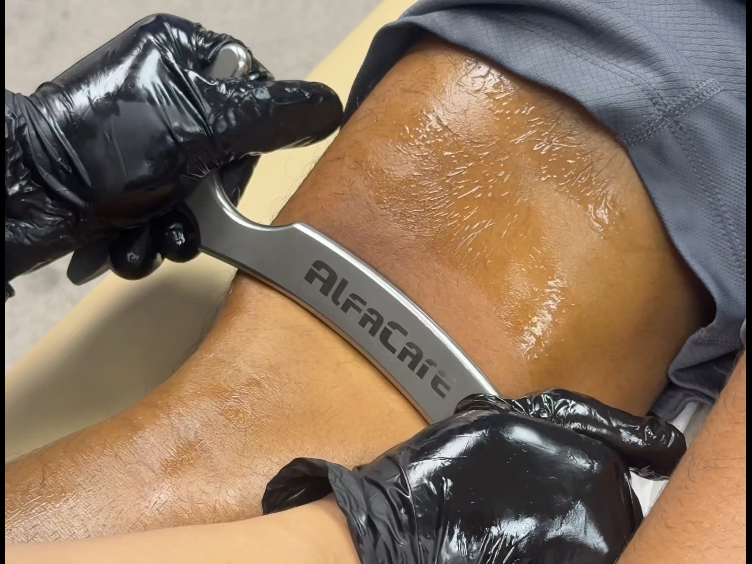 jj having manual IASTM