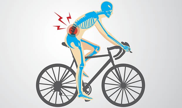 Why Cycling Blocks Your Power: Fixed Hips, IT Band Tightness & Lower Back Pain 3 Sports massage in Manchester for cyclist lower back pain