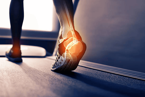 Plantar fasciitis treatment in Manchester